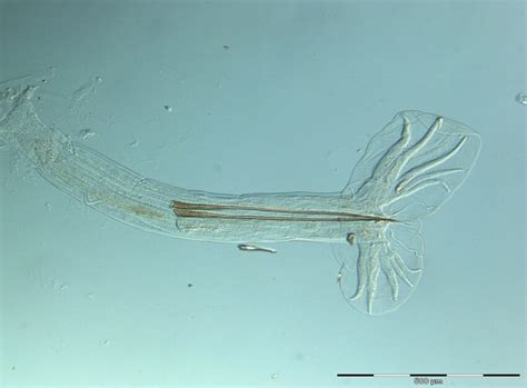  Isodictya: A Masterpiece of Needle-Like Spicules for Filtering Tiny Organisms!