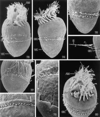  Strombidium! This Microscopic Master Swims Through Water With Exquisite Cilia Control