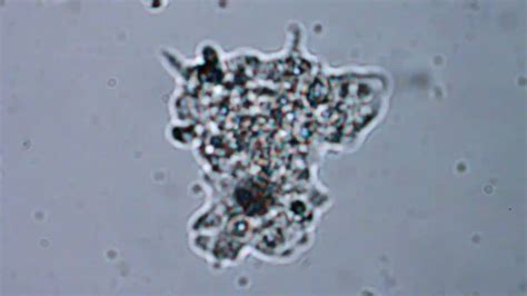  Testamoeba! A Tiny Blob with an Epic Microscopic Journey